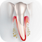 Tratamente parodontic